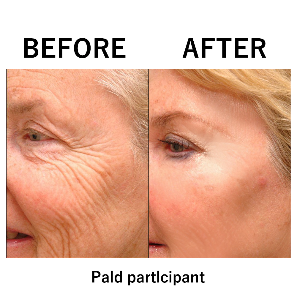 💖Instant Temporary Face Tightener