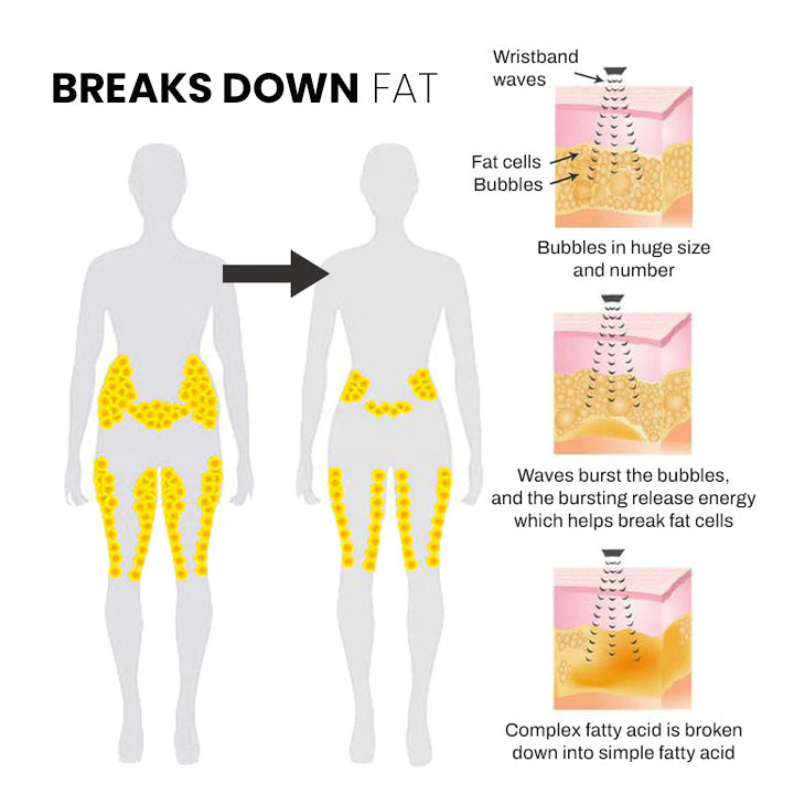 🔥Histone™  Ultrasonic Body Shape Wristband Pro 🔥