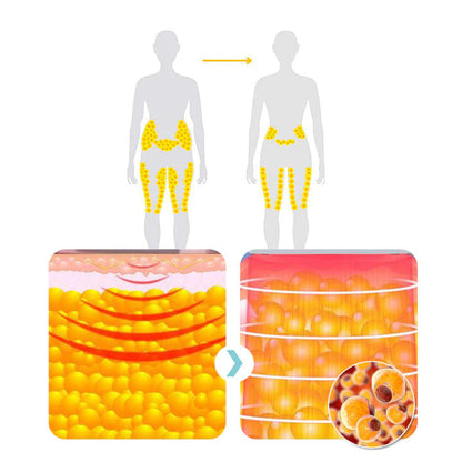 🔥Histone™  Ultrasonic Body Shape Wristband Pro 🔥